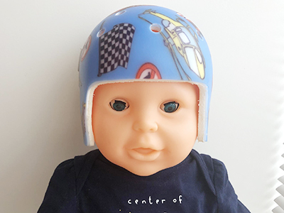 頭蓋形状矯正ヘルメット治療 赤ちゃんの頭の形を矯正するヘルメット治療の赤ちゃんのあたまのかたちクリニック